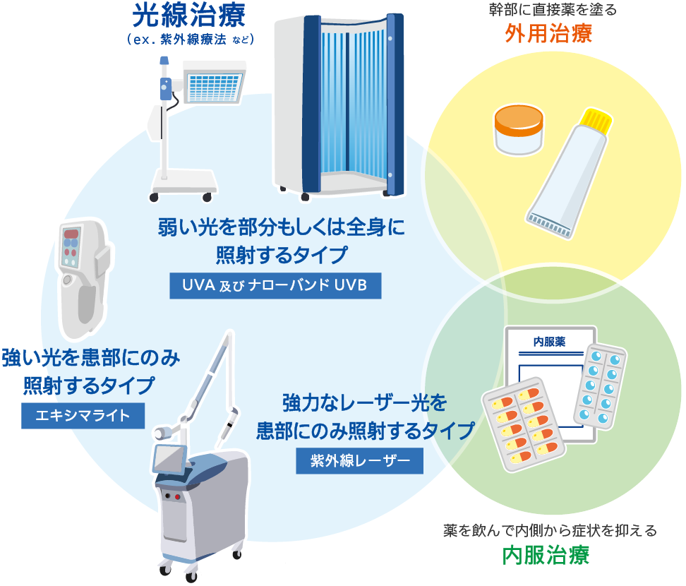 光線治療（ex.紫外線療法）エキシマライト・エキシマレーザー・ナローバンドUVB