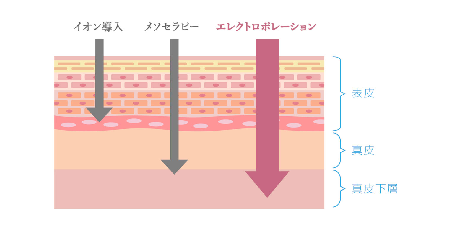 スプリング　エレクトロポレーション　エレポ　spring　美容機器　イオン導入　メソセラピー